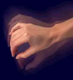 Parkinson Hastalığı Nasıl Seyreder